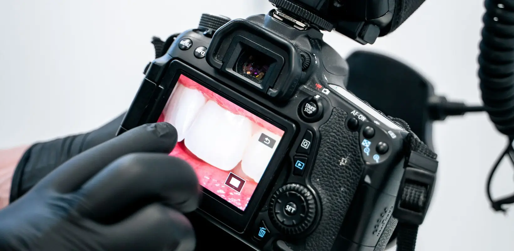 We work with shape, color, and proportions while preserving your teeth.